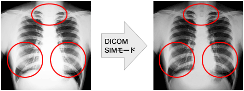 DICOM SIMモード 比較イメージ