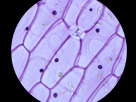 マイクロスコープアダプター(顕微鏡アタッチメント)で、顕微鏡の映像も投写可能